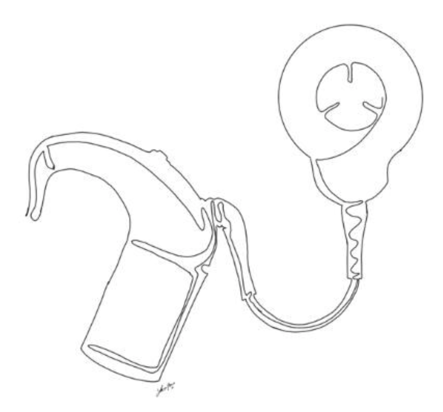 Cochlear Implant